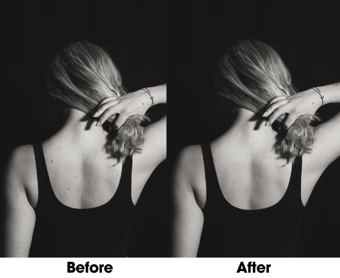 How to Remove Acne From Photos with AI Blemish Remover